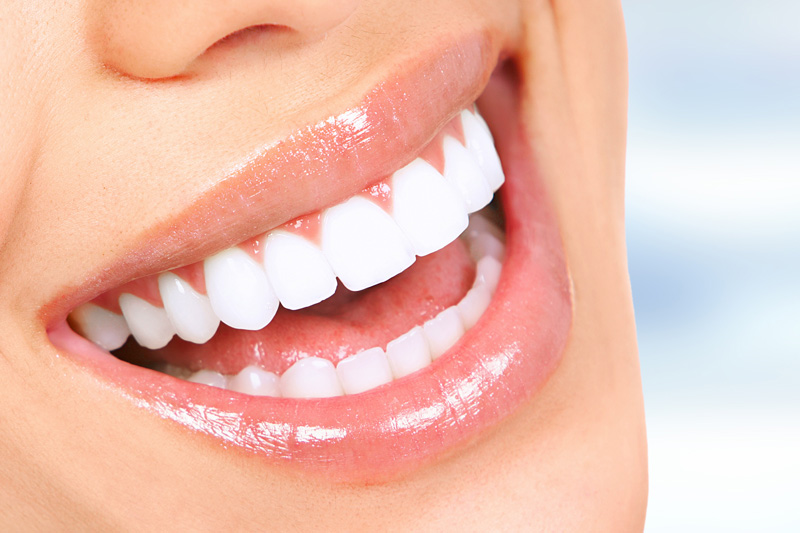 Cosmetic Dentistry in Ozark